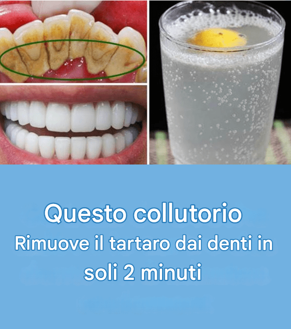 Questo collutorio sostituisce la lastra in modo naturale.