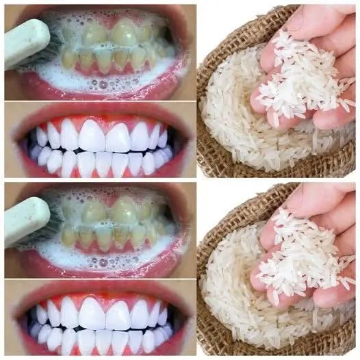 Sbianca i denti in solo 1 minuto con questa semplice cosa casalingo