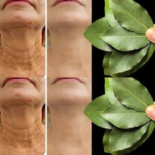 Il Botox è 100.000 volte più efficace? | Anche Natural Anti-Rough ha 70 anni!