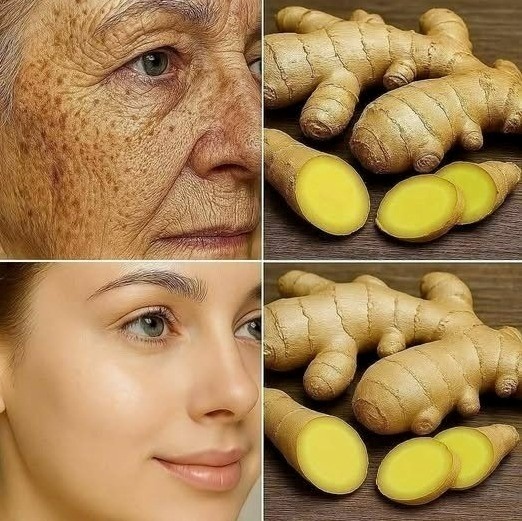 Lo zenzero è 100 volte più efficace del Botox nell’eliminare rughe profonde, lentiggini e discromie. Devo dire qualcosa per poter continuare a ricevere le mie ricette… Grazie! 😍