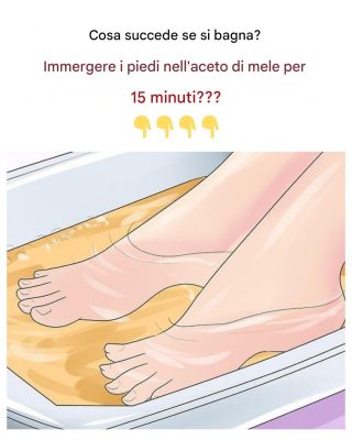 Pediluvio con aceto di mele: l’ho provato per 15 minuti e questo è il risultato.