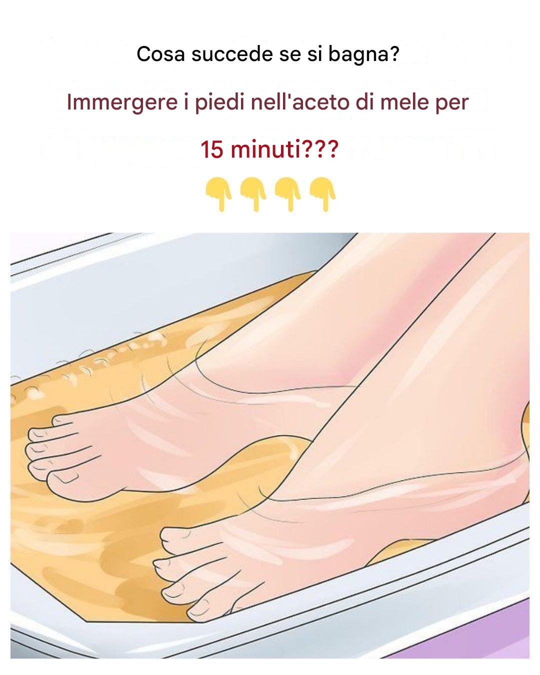 Pediluvio con aceto di mele: l’ho provato per 15 minuti e questo è il risultato.