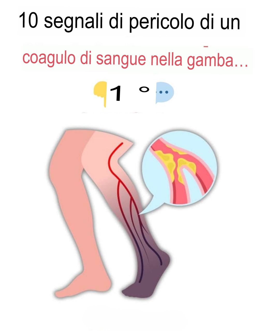 10 segnali d’allarme di un coagulo di sangue nella gamba che dovresti conoscere