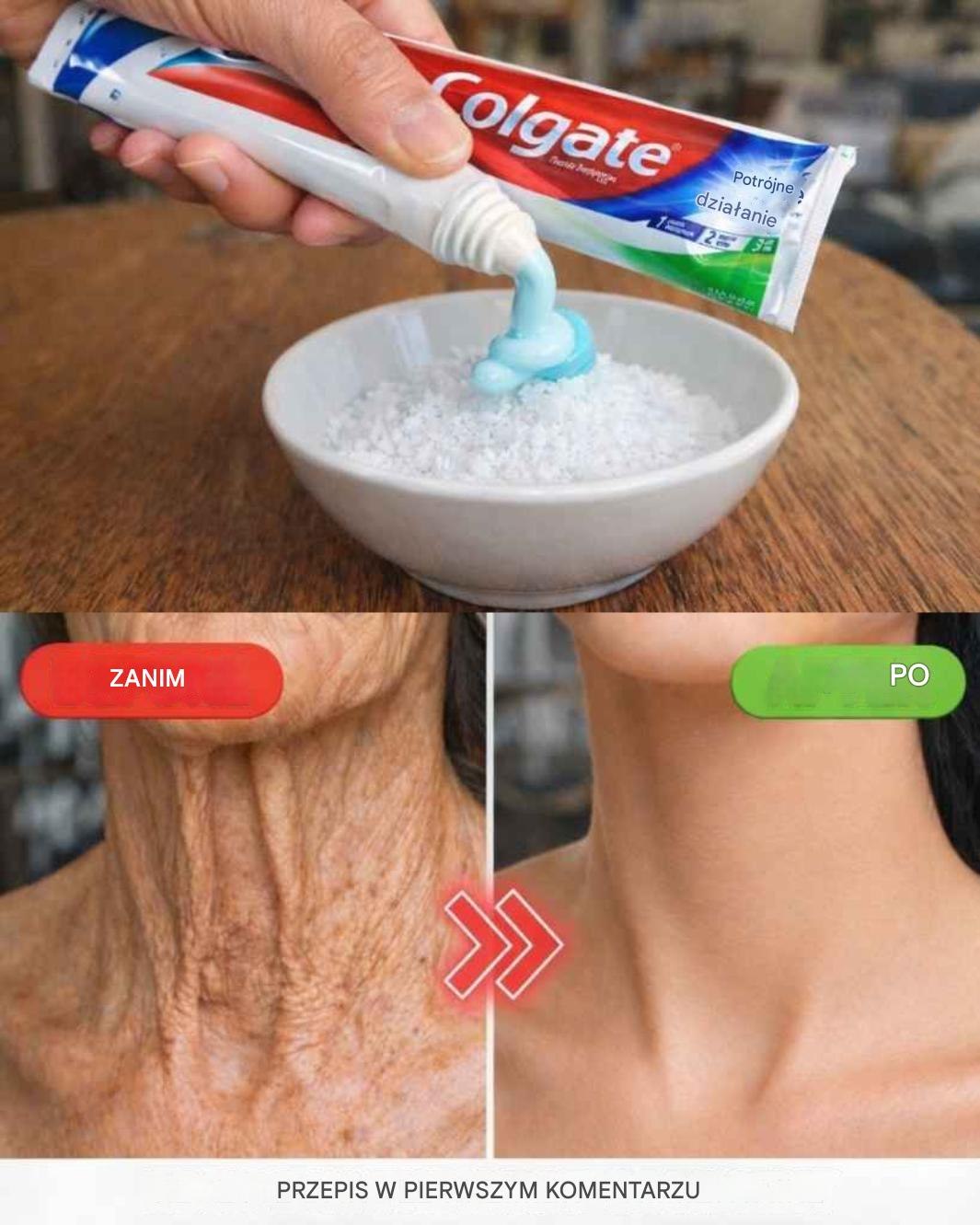 “La gente pensa che io sia un chirurgo plastico!” – Un metodo naturale per levigare rughe e discromie su mani e braccia (ricetta semplice all’interno)