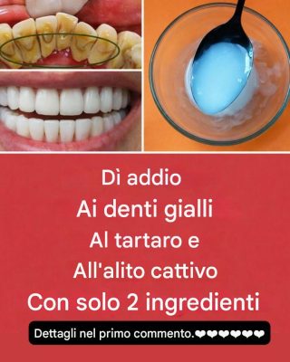 Dì addio a denti gialli, tartaro e alito cattivo con solo 2 semplici ingredienti