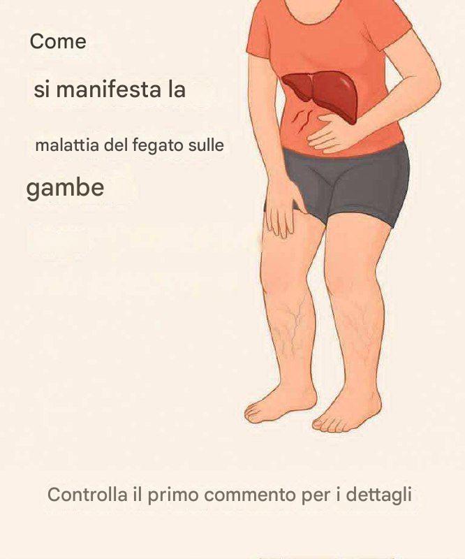 Malattie del fegato: sintomi, cause, stadi e trattamento