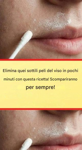 Questa ricetta naturale rimuoverà definitivamente i peli del viso.