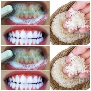 Sbiancamento dentale rapido in 1 minuto!