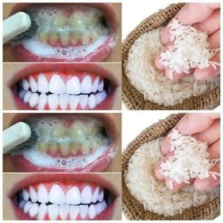Sbianca i denti in appena 1 minuto con questo semplice rimedio casalingo.