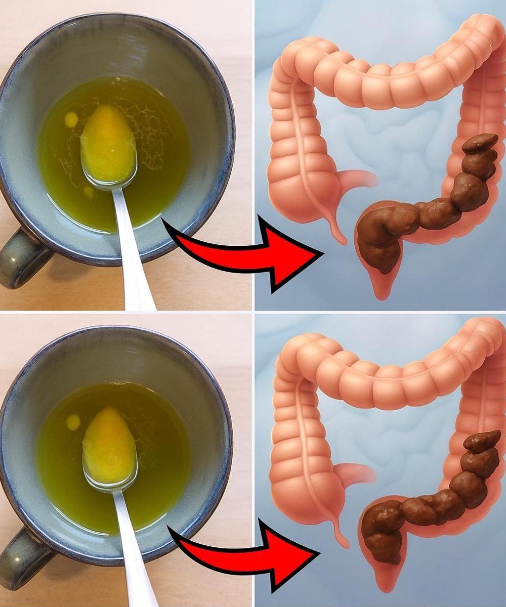 Un rimedio per la pulizia dell’intestino crasso