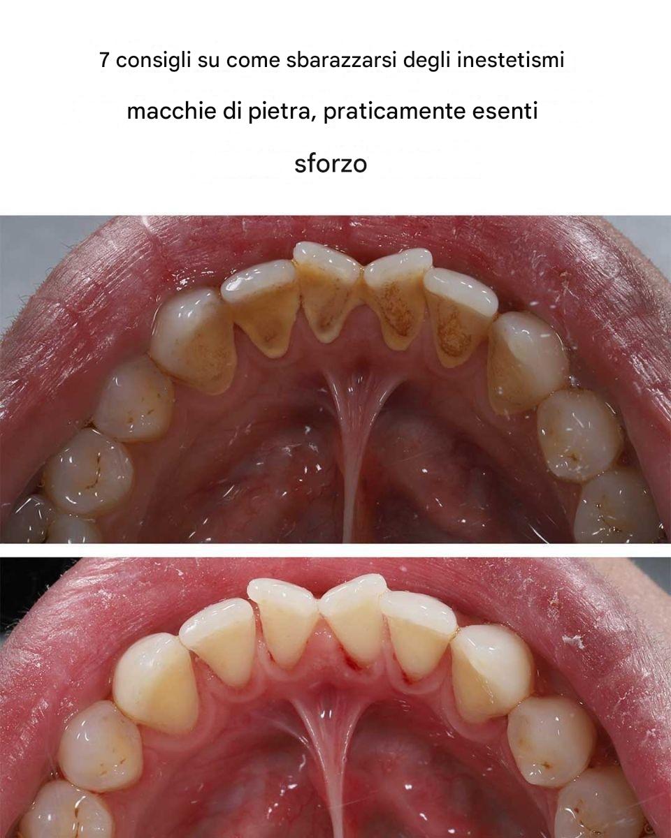 7 consigli per eliminare le antiestetiche macchie di pietra praticamente senza alcuno sforzo