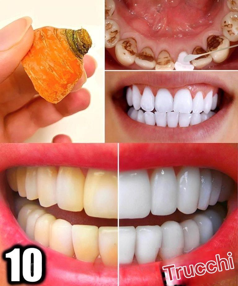10 trucchi naturali per sbiancare i denti a casa in soli 3 giorni (senza bisogno del dentista)