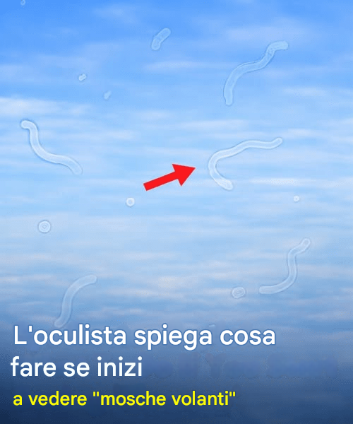 Cosa fare se si iniziano a vedere corpi mobili nel campo visivo: una guida utile da un oculista