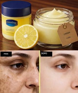 Ho scoperto la ricetta miracolosa di mia nonna per una crema! Con soli 3 ingredienti: vaselina, succo di limone e crema da notte, la mia pelle è diventata radiosa. Dovete assolutamente provarla! Salvate questo post e leggete il primo commento per la ricetta completa.